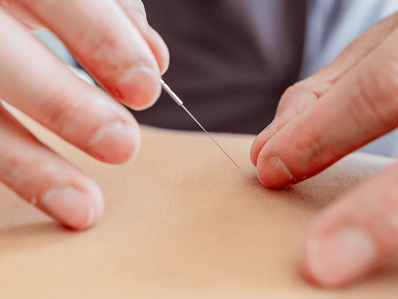 鍼による痛みを最小限に抑える イメージ