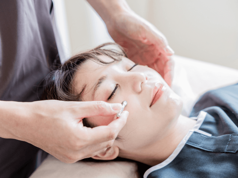 美容鍼コース イメージ